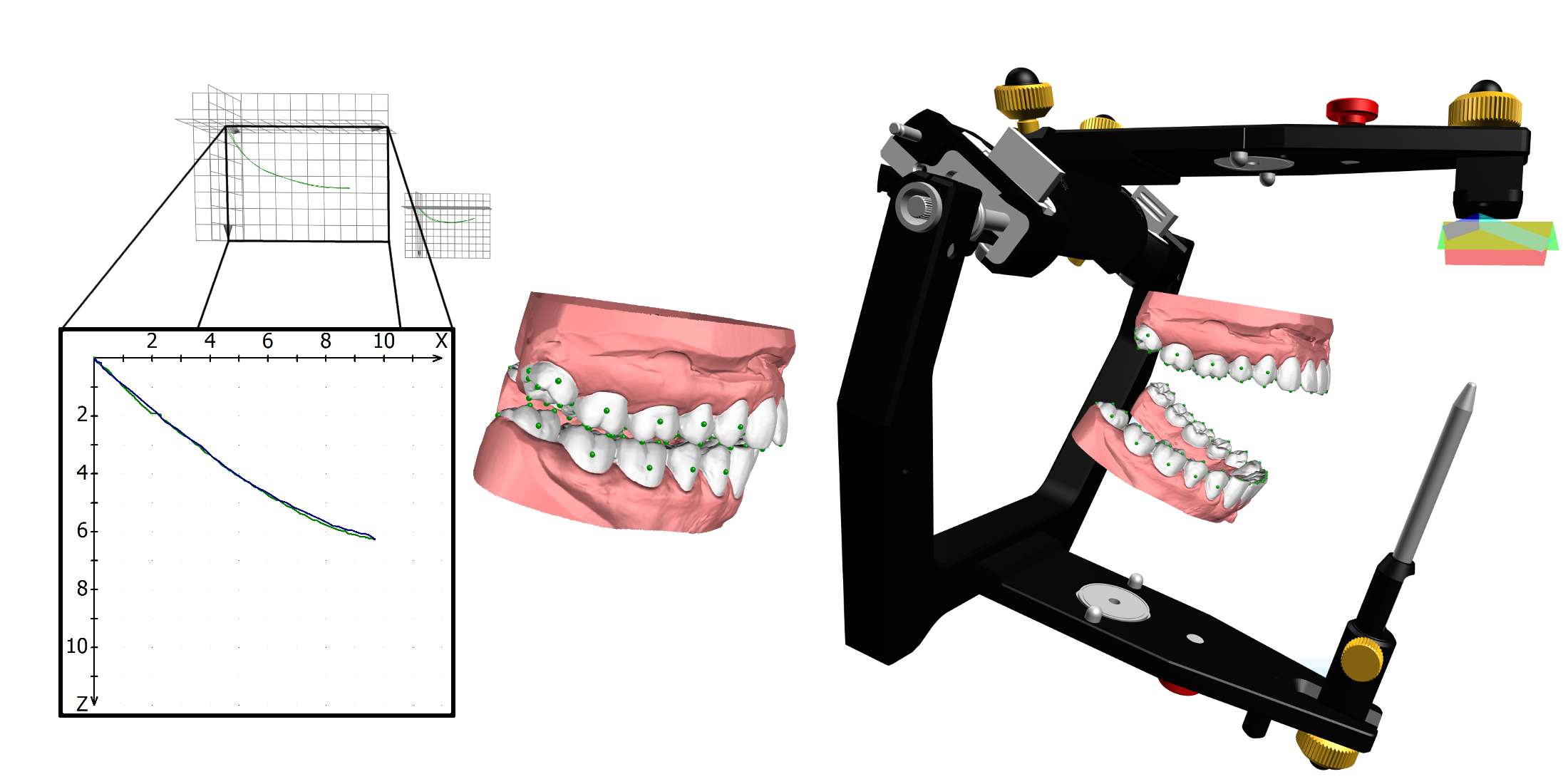 Articulation GAMMA Dental